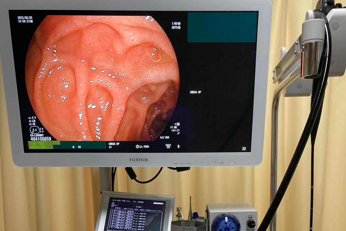 上部消化管内視鏡検査（食道・胃・十二指腸検査）
